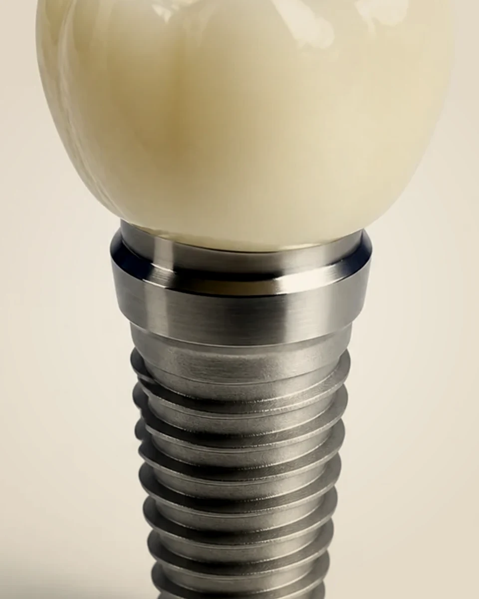 Dental implant and ceramic crown, AI-generated product illustration