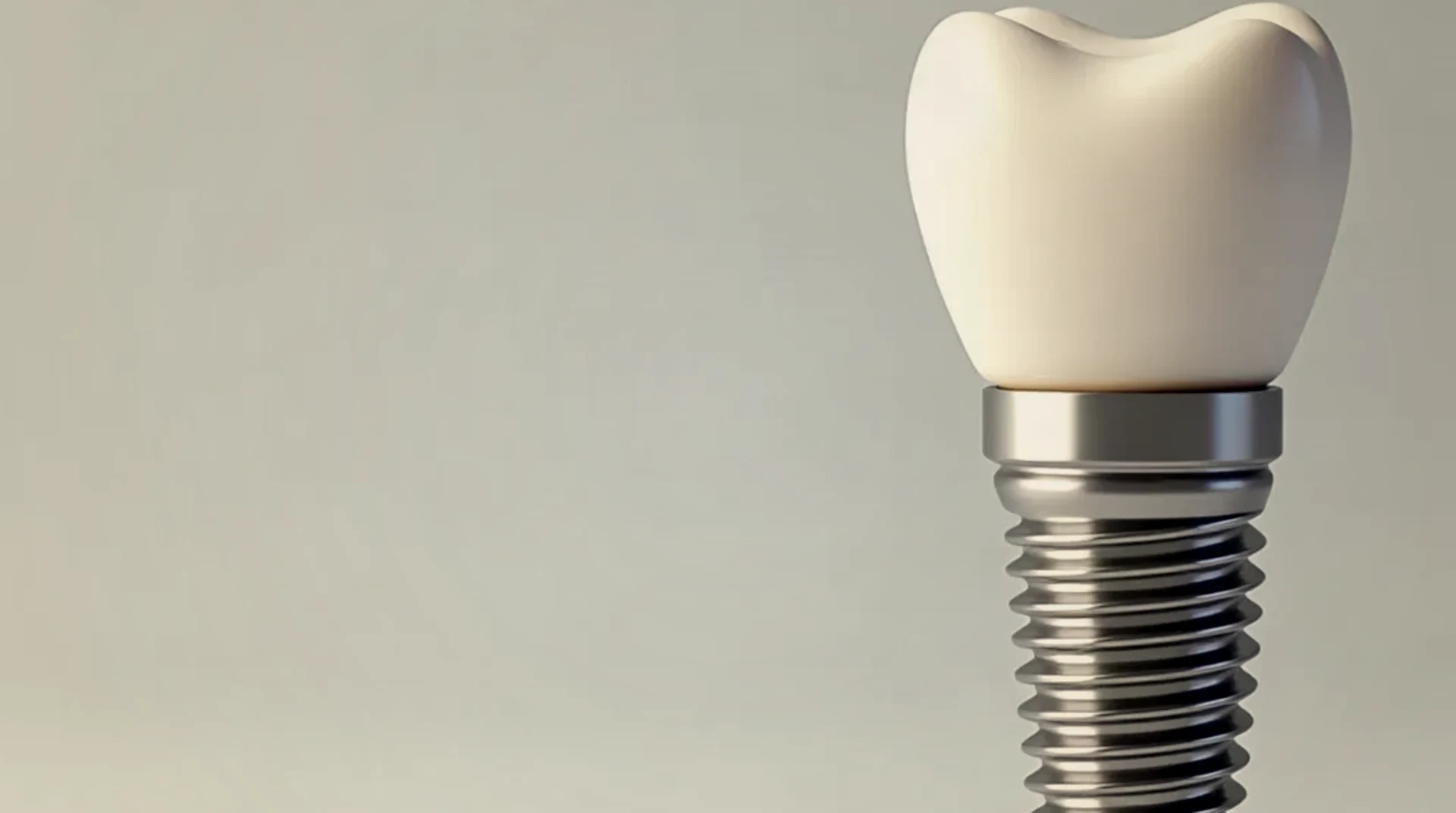 Dental implant and ceramic crown, AI-generated illustration, not a patient